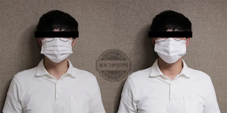 덴탈형 주름진 마스크 올바른 착용법 (Feat. KF-AD 침방울차단 마스크)