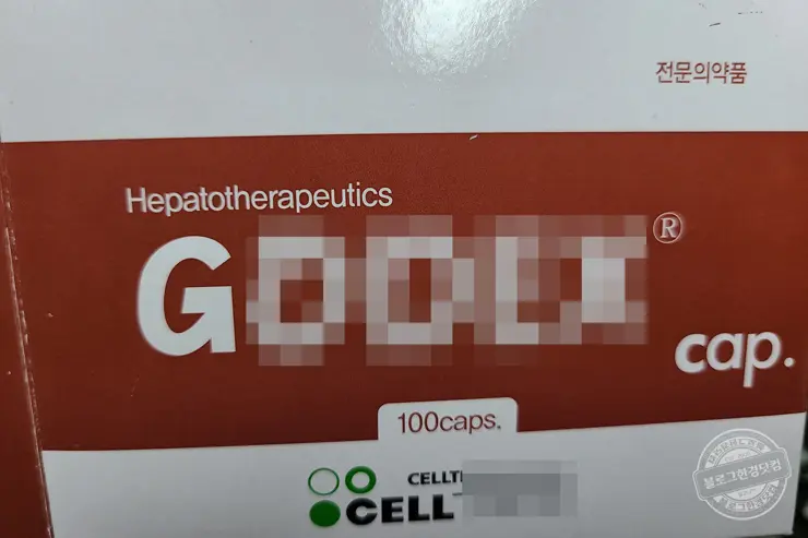 국민건강검진 간수치 ALT 기준 초과 초음파 간검사 지방간 판정