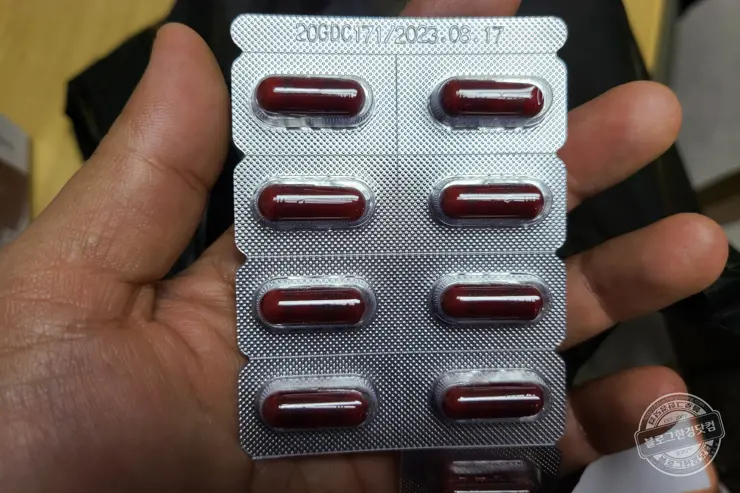 국민건강검진 간수치 ALT 기준 초과 초음파 간검사 지방간 판정