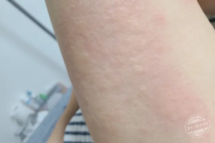 코로나19 얀센 백신 예방접종 당일 연기 후기 (노쇼 취소 방지 팁)