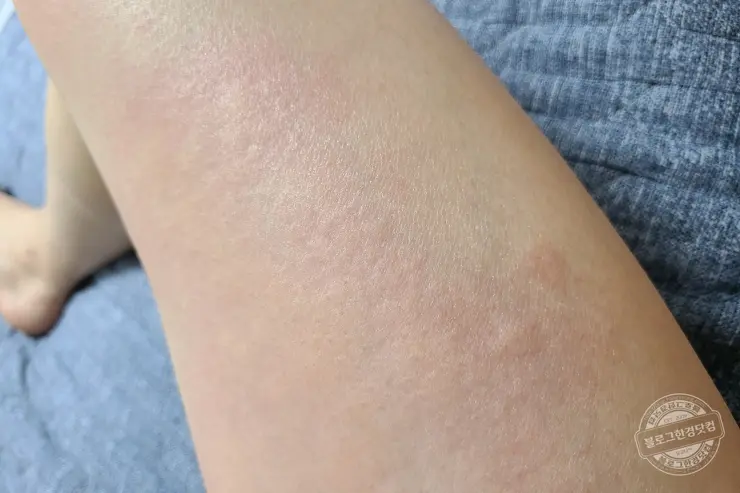 코로나19 얀센 백신 예방접종 당일 연기 후기 (노쇼 취소 방지 팁)