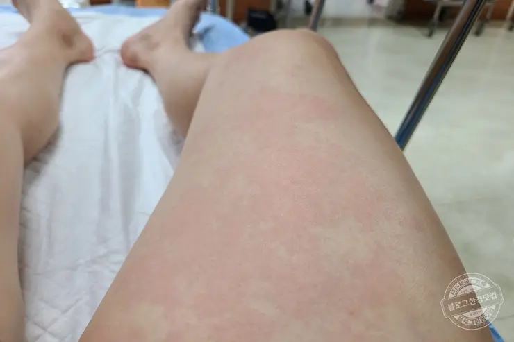 코로나19 얀센 백신 예방접종 당일 연기 후기 (노쇼 취소 방지 팁)