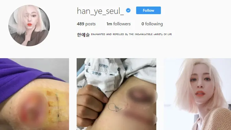 한예슬 의료사고 인스타그램 사진 공개